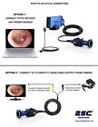 Endoscopy Camera Hd Portable Usb Rigid Endoscope Ent Medical 1 2mp Windows