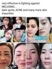 Cream Facial Set Blue From Thailand