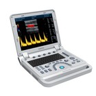New Cms1700a Portable Color Doppler Ultrasound Scanner Machine convex Probe