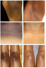 Dark Skin Bleaching  Whitening Lightening Cream Aha - Face   Body  15g 