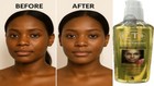 Kojic Acid Skin Whitening Lightening Brightening Serum Dark Spot Fade With Aha
