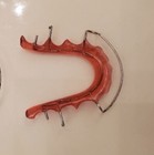 Custom Hawley Retainer Upper  New Orthodontic Dental Braces Teeth Impression Kit