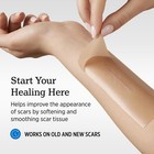 Nuvadermis Silicone Scar Sheets For Surgical Scars - 120  X 1 Pack  Light