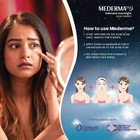 Mederma Pm Old   New Acne Scar Removal Cream 10gm