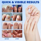 21pcs box Fungal Nail Care Patches  Box 8h Overnight Toenail Repair Care 