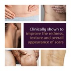 Mederma Advanced Scar Gel Skin Protectant Reduce Appearance Of Old   New Scars