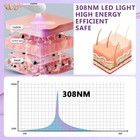 308nm Home Phototherapy Uvb Light Lamp Device For Skin Diseases Treatment Kts