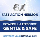 Athlete   s Foot Treatment Cream     Extra Strength Antifungal For Cracked Heels    