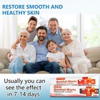 Wart Remover Fast Acting Gel Wart Remover Freeze genital Wart Freeze For Genital