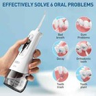Water Flosser 300ml Cordless Oral Irrigator Dental Floss Teeth Cleaner