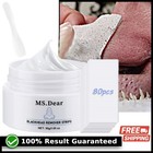 Blackhead Remover With 80pcs Strips Deep Cleansing Peel Off Mask For Nose   Face