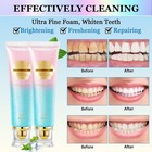 2pcs Acssart Radiant Whitening Toothpaste  Niacinamide Intensive White Toothpast