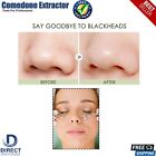 4pcs Pimple Remover Extractor Tool Stainless Blackhead Facial Spot Acne Comedone