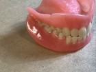 Vintage  Full Set Upper   Lower Dentures New Condition Dentistry Collectible