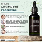 Lactic Acid Skin Peel For Acne Wrinkles Melasma Age Spots 25  40  50  90 