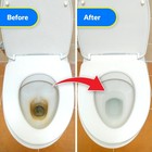 X-all Foaming Toilet Cleaner  Self-activating Powder For Deep Cleaning    