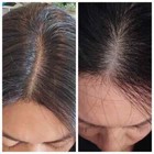 Hair La Vie Clinical Formula Hair Vitamins With Biotin   Saw Palmetto     2-pack