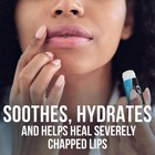 Chapstick Classic Medicated Lip Balm Tubes chapped Skin Protectant - 0 15x12 Oz
