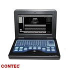 Contec Portable Laptop Machine Digital Ultrasound Scanner M  quina De Ultrasonido
