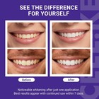 Ceelike Purple Teeth Whitening Strips  Pap   Nhap  42 Strips   21 Treatment  