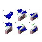 Dental Mini Rubber Dam Silicone Wedges Soft Gingival Protection Guard 2 3 Holes