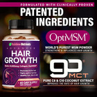 2x Hair Growth Vitamins For Women   Biotin 10 000mcg  Collagen Optimsm 4 28 240
