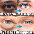 Remove Dark Circles Wrinkles Face Lines Puffy Eyes Under Eye Cream