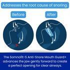 Somnofit-s Anti-snore Mouth Guard    Luxury Snoring Mouthpiece   Swiss Made