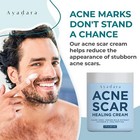 Acne Scar Healing Cream For Face Stretch Marks Body Scars 2 Pack Ayadara