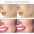 New 794587323958 Tumakou High Frequency Facial Machine 4 Tubes