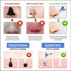 Electric Blackhead Remover Pore Vacuum Suction Diamond Dermabrasion Face Cleaner