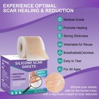 Silicone Scar Sheets  Medical Grade Silicone Scar Tape  1 6  X 120    Profess   
