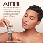 Ambi Skin Dark Spot Fade Cream Lightening Bleaching Cream Dark Spot Whitening