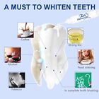 35 cp Teeth Whitening Kit With Usb Light For Home Tooth Whitening Gel Whitener