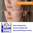 Scar Removal Cream - Old Scars Stretch Mark Spots  Surgery  Burn  Injury Scar