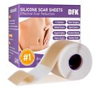 Silicone Scar Sheets   Tape Roll  3m    Scar Removal  Keloid surgery  Acne marks