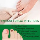 7-day Toenail Fungus Treatment  2 Pack  Extra Repair For Discolored Nails 30mlx2