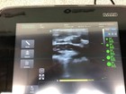 Bard Site Rite 950041600 Halcyon Ultrasound System