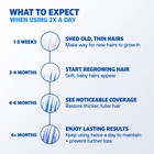 Men   s Rogaine 5  Minoxidil Solution 3 Month Supply 3 Bottles Hair Regrowth