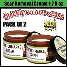 Scar Acne Removal Stretch Marks Old Scars Burns Repair Cream 1 7 Fl Oz  Pack 2