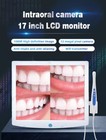 17 Inch Dental Intra Oral Camera Wifi High Definition Digital Lcd Aio Monitor 5g