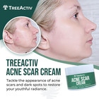Acne Scar Treatment  2 Fl Oz  Acne Scar Cream For Face  Gentle Acne Scars And Da