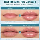 Gyctst Bp Spicule Lip Plumper Gloss  Vitamin E Hydrating Plumping Shot For Fulle