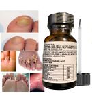 2 Anti-fungal Maximum Strength Toenail Fungus Athletes Foot Fungi Nail  Support