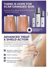Biocorneum Advanced Scar Treatment With Broad Spectrum Spf 30  Size 50g