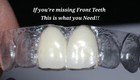 Retainer With Teeth  Affordable Way To Fill In Your Smile  With 1-5 Teeth Added 
