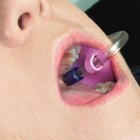 50pcs bag Dental Suction Tube Holder Tube Saliva Ejector Hve Tube Positioner
