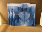 Lorde Autographed    virgin    Gatefold Vinyl Record Signed Limited Edition X-ray