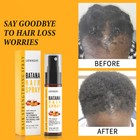 Oil Batana Hair Growth Spray Anti Hair Loss Fast Regrowth Scalp Remedy Serum