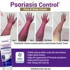 Triderma Psoriasis Control Face   Body Cream  No Cortisone  Fsa Eligible  4 2 Oz